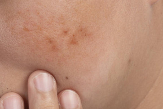 Guide pratique anti-taches corps et visage